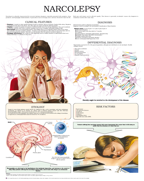 narcolepsy type 1 symptoms