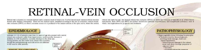 Retinal-vein occlusion