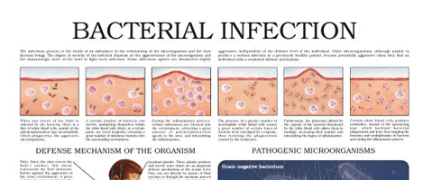 Bacterial infection