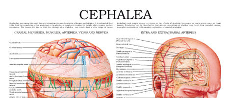 Cephalea