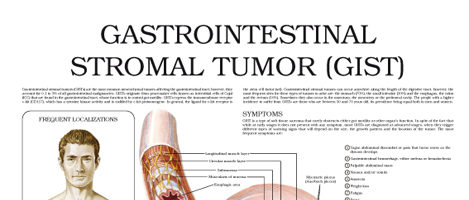 Gastrointestinal Stromal Tumors (GISTs)