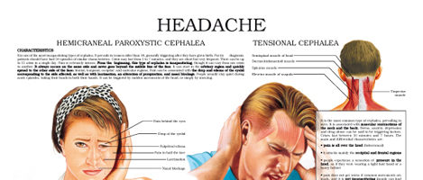 Headache, neuralgia cephalea and migraine