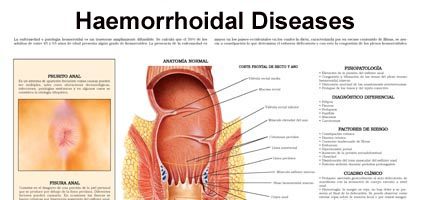 Hemorrhoidal diseases