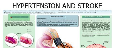 Hypertension and stroke