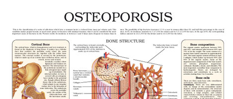 Osteoporosis (III)