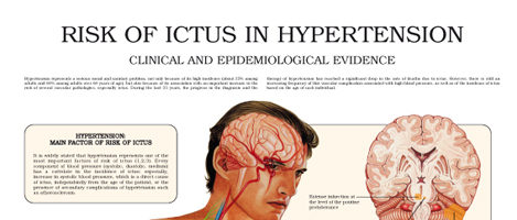Risk of ictus in hypertension