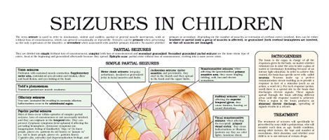 Seizures in children