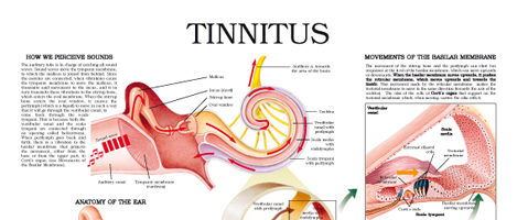 Tinnitus and the ear