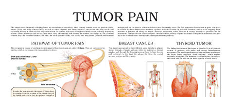 Tumor pain