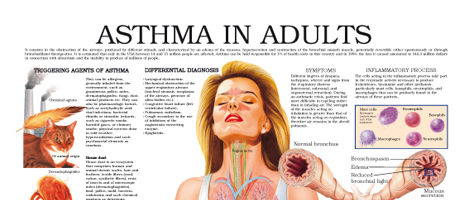 Asthma in adults
