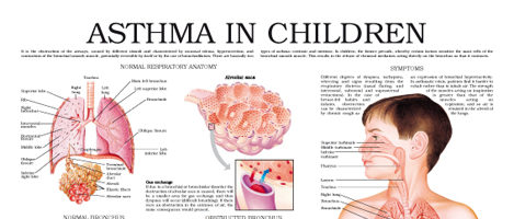 Asthma in infants (II)