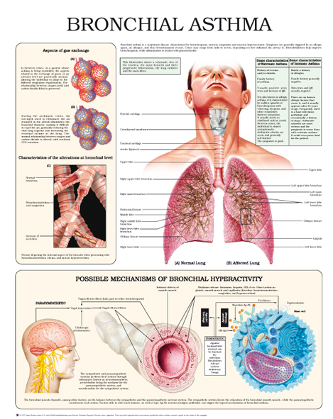 Bronchial Asthma Anejo