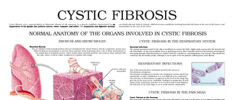 Cystic fibrosis