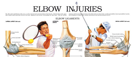 Elbow injuries