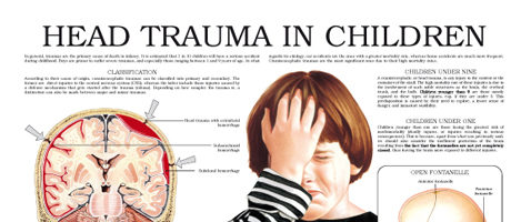 Head trauma in children