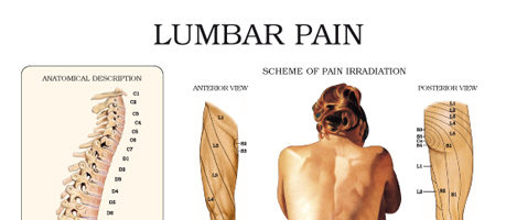 Lumbar pain