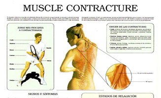 Muscle contracture