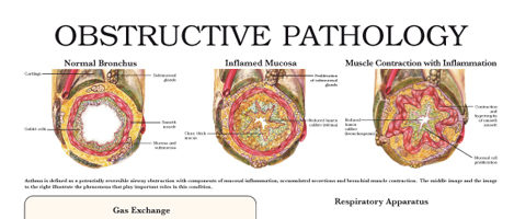 Obstructive pathology