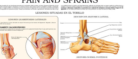 Pain and sprains