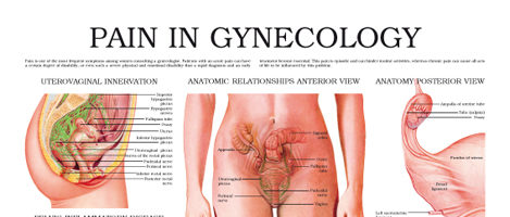 Pain in gynecology