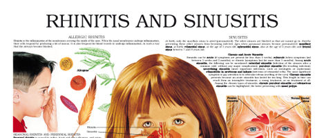 Rhinitis and sinusitis