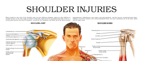 Shoulder injuries
