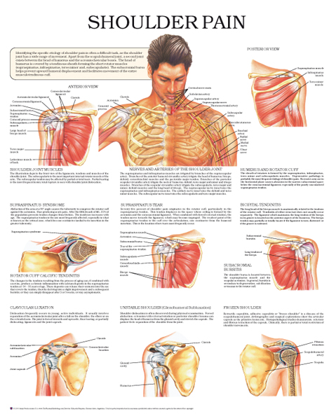 Shoulder Diagnosis Chart