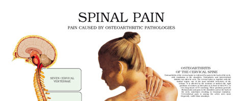 Spinal pain