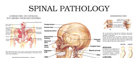 Spinal pathology